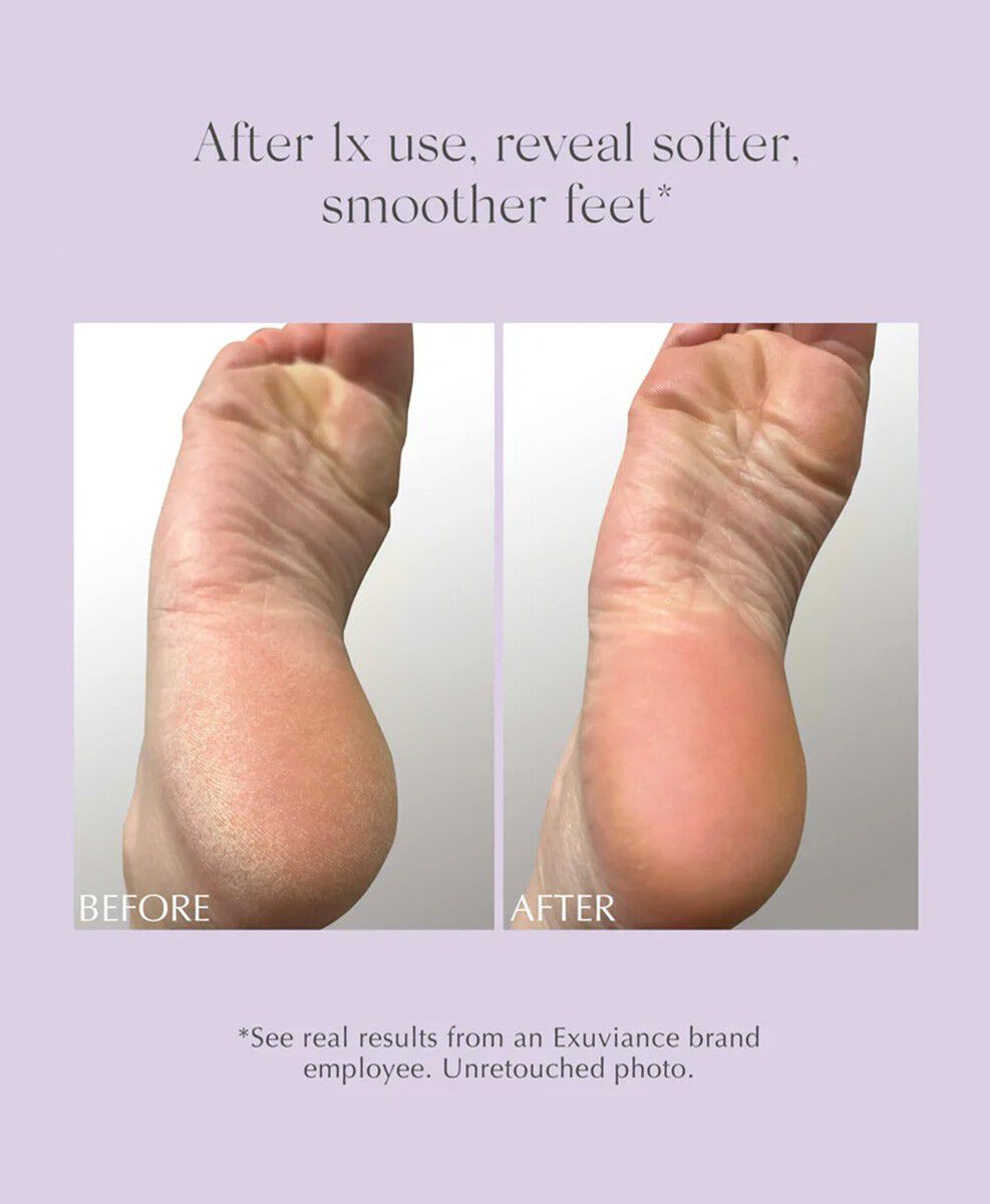 Exfoliating & Conditioning Foot Balm