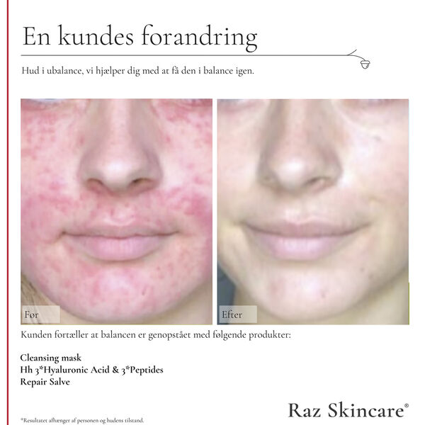 Raz Skincare Cleansing Mask 200 g