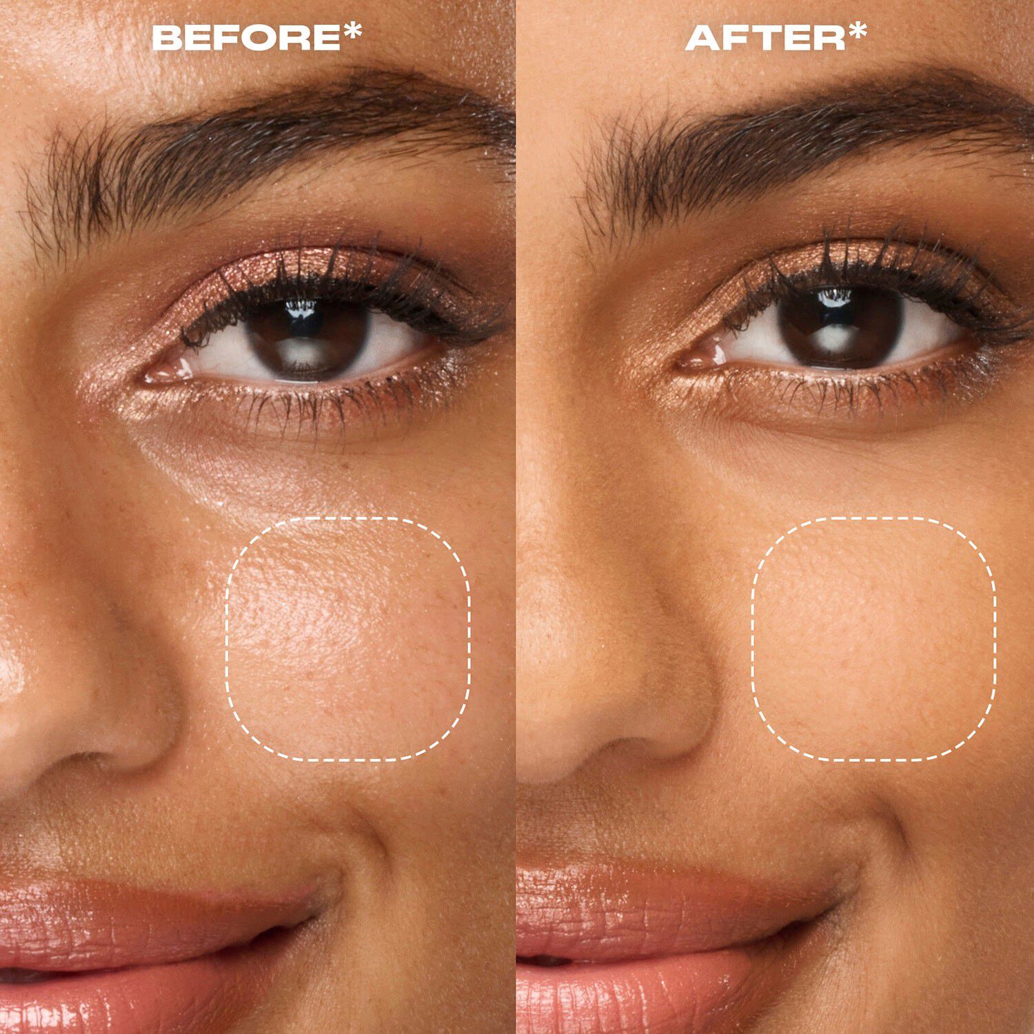 Secure the Blur - Blurrande och fixerande bas