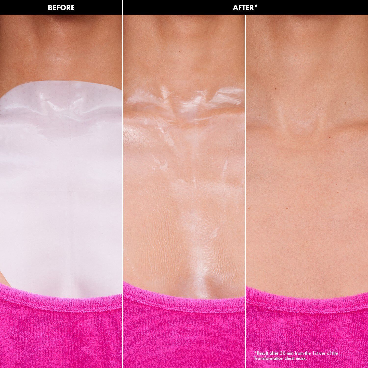 Transformation masks - Hydrogelmasker f&ouml;r ansikte