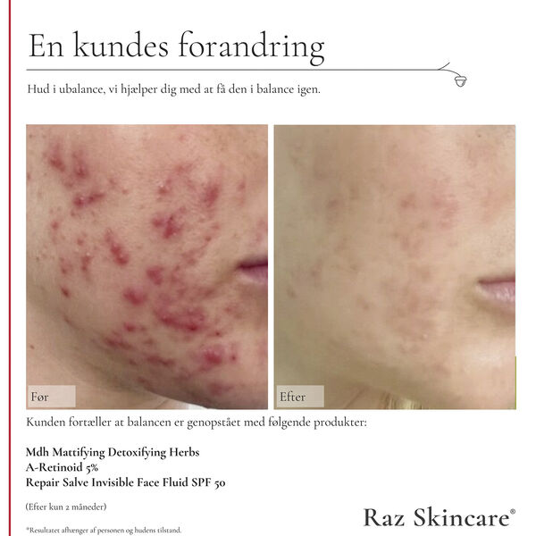 Raz Skincare Mdh Mattifying Detoxifying Herbs 30 ml