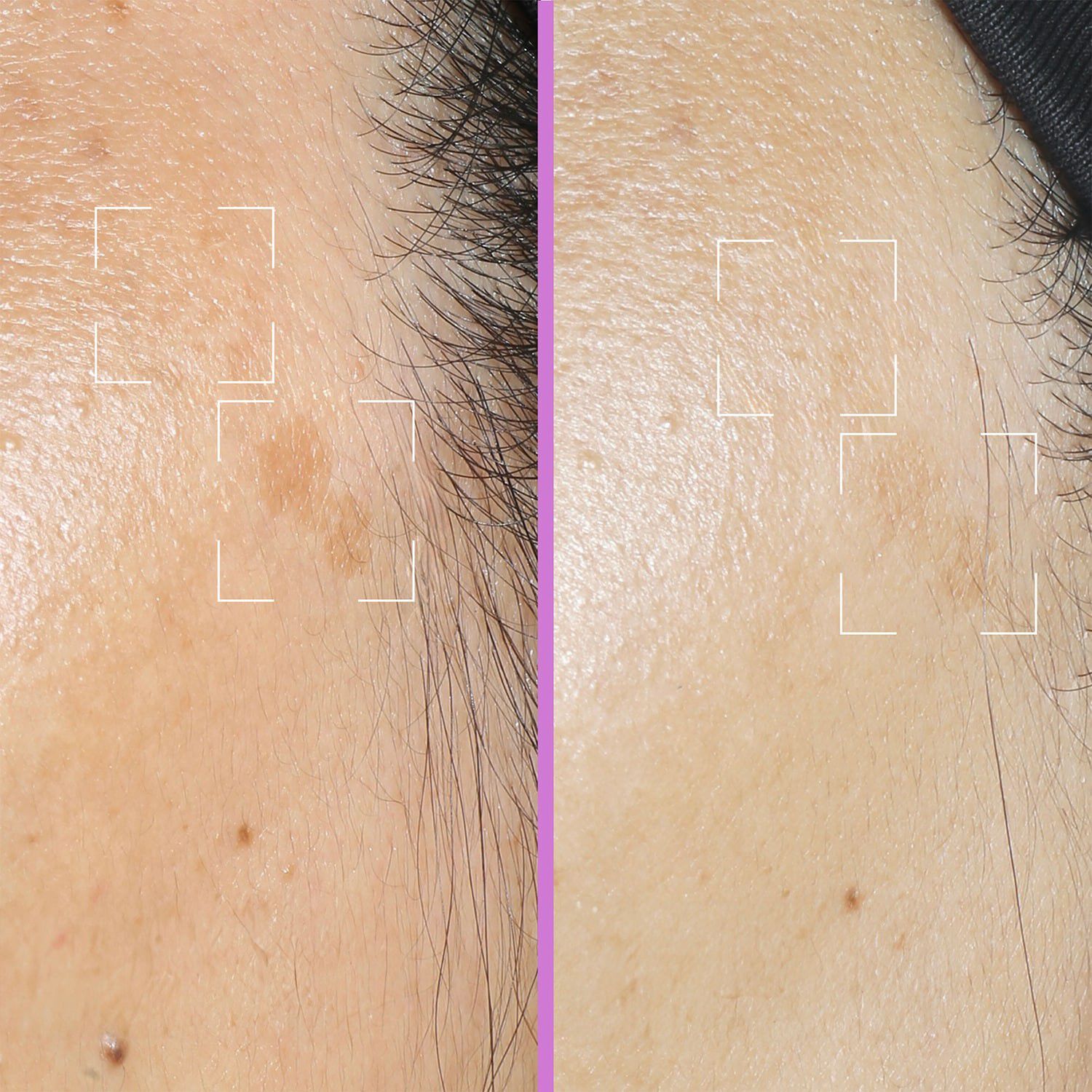 Spotless Capsules - Serum mot m&ouml;rka fl&auml;ckar med niacinamid, vitamin C