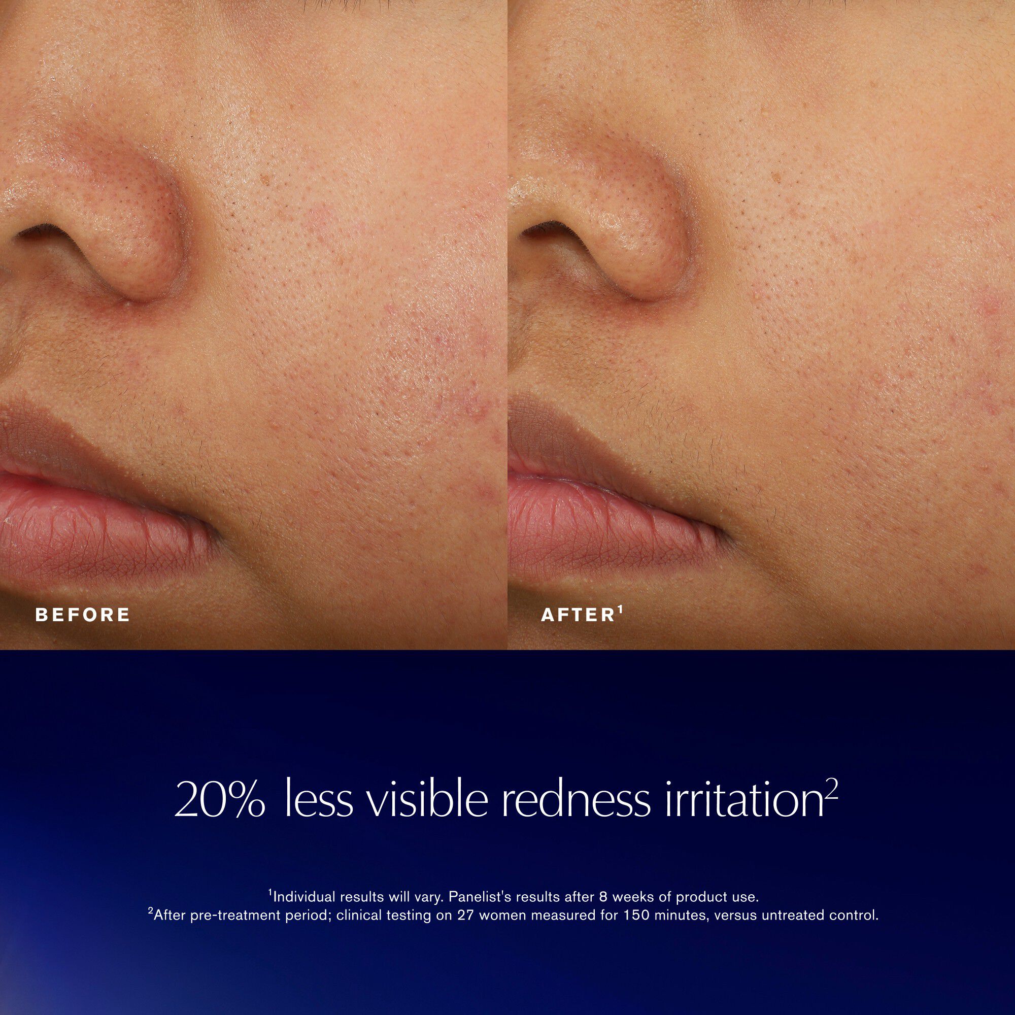 Advanced Night Repair Recovery Treatment Essence