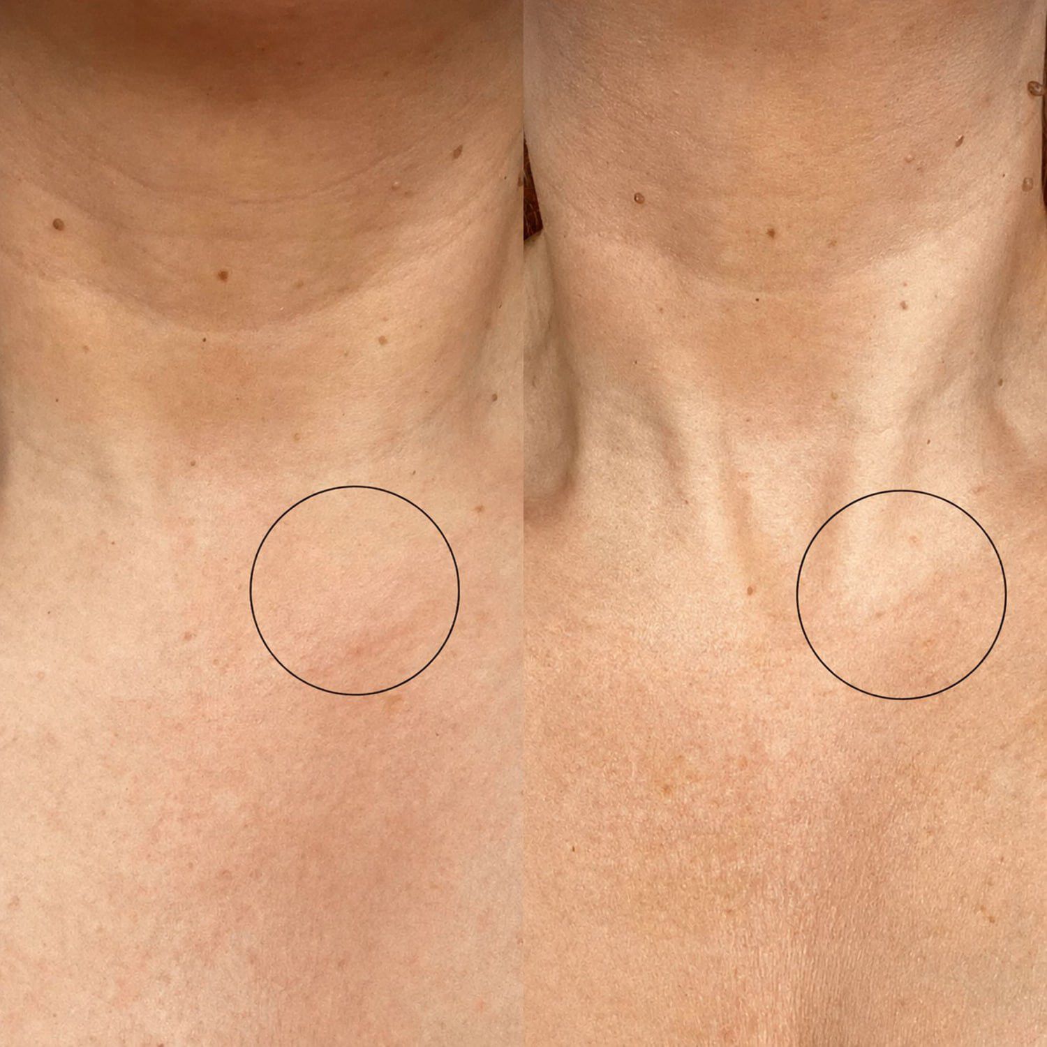 Bio-active Ceramide Neck Stick - Stift f&ouml;r halsen med bioaktiv ceramid