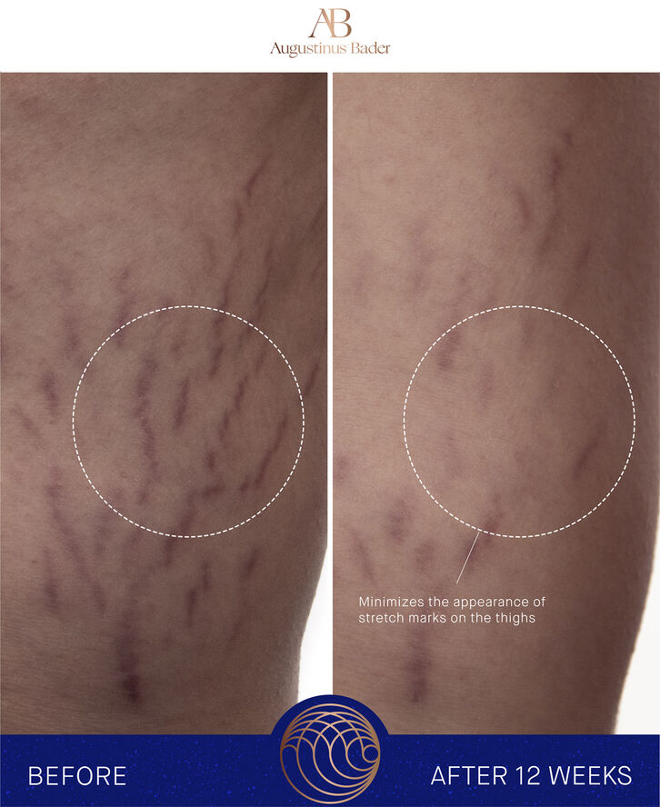 The Body Cream