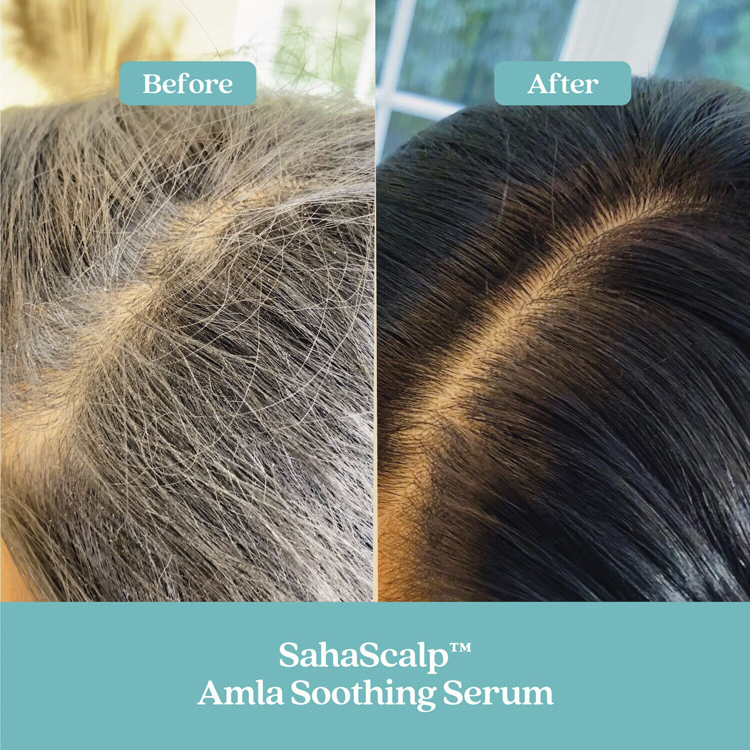 SahaScalp - Amla Soothing Scalp and Hair Serum