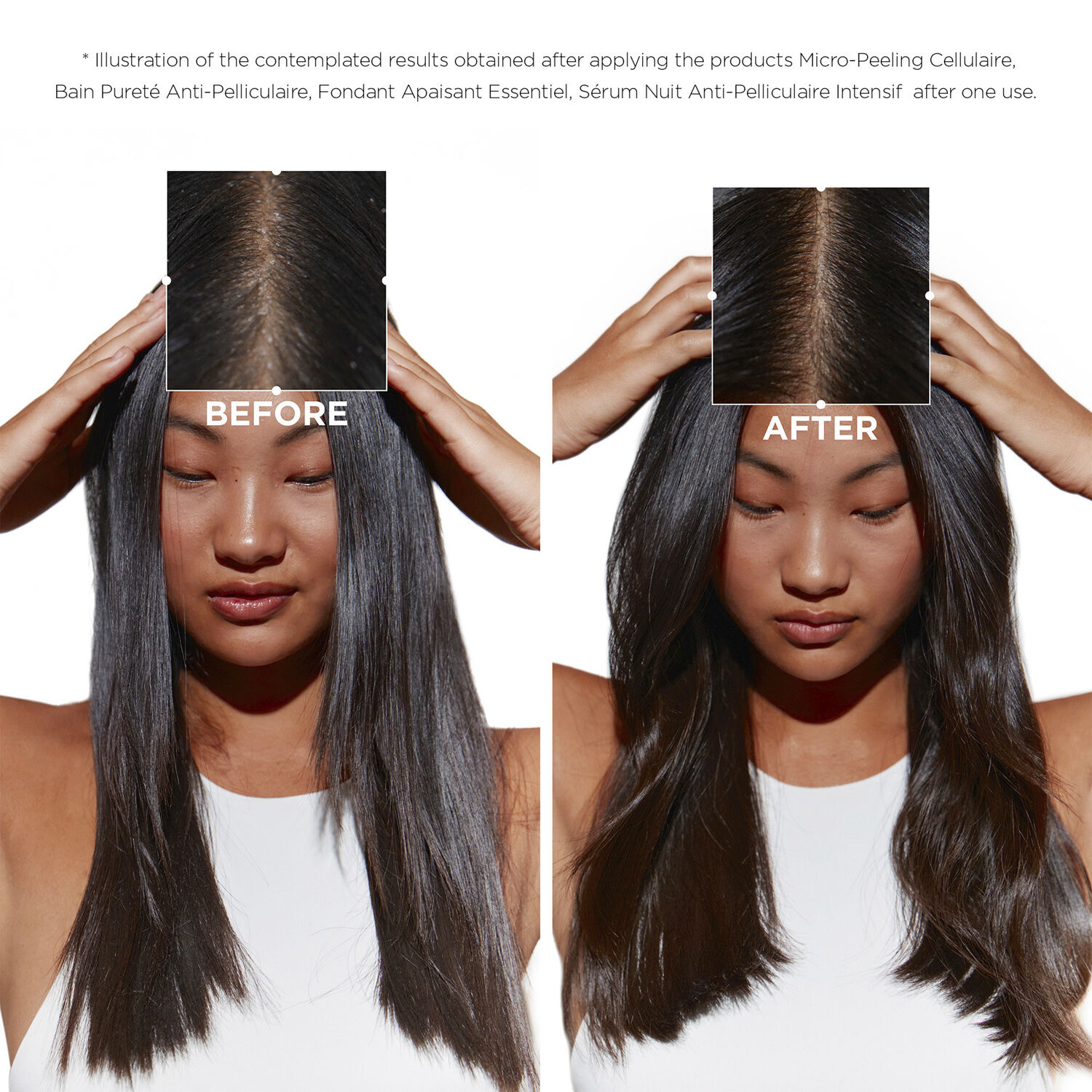 K&eacute;rastase Symbiose Bain Puret&eacute; Anti-Pelliculaire Shampoo 500ml