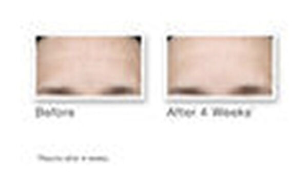 Multi-Vitamin Infusion Oil