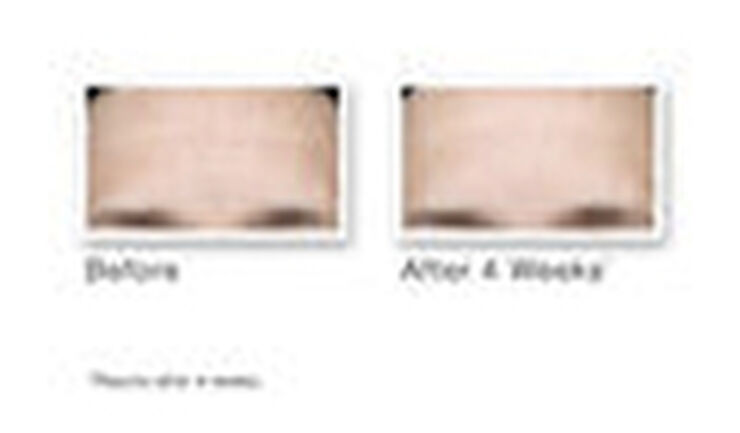 Multi-Vitamin Infusion Oil