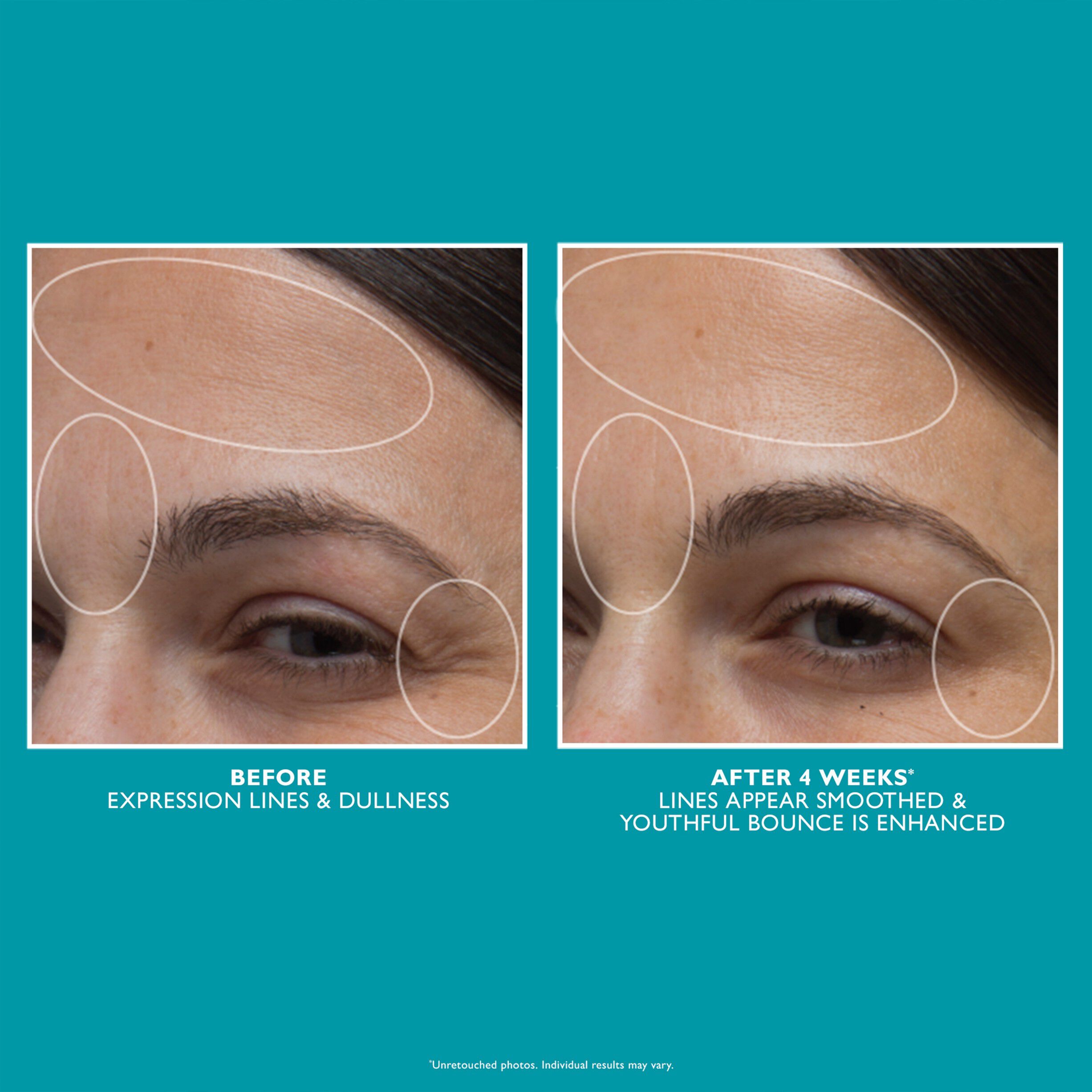 Peter Thomas Roth Peptide Skinjection Moisture Infusion Cream 50 ml