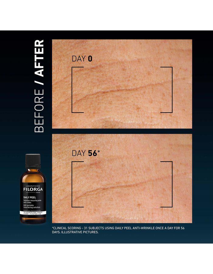 Clinical Home Peel Wrinkles 50 ml