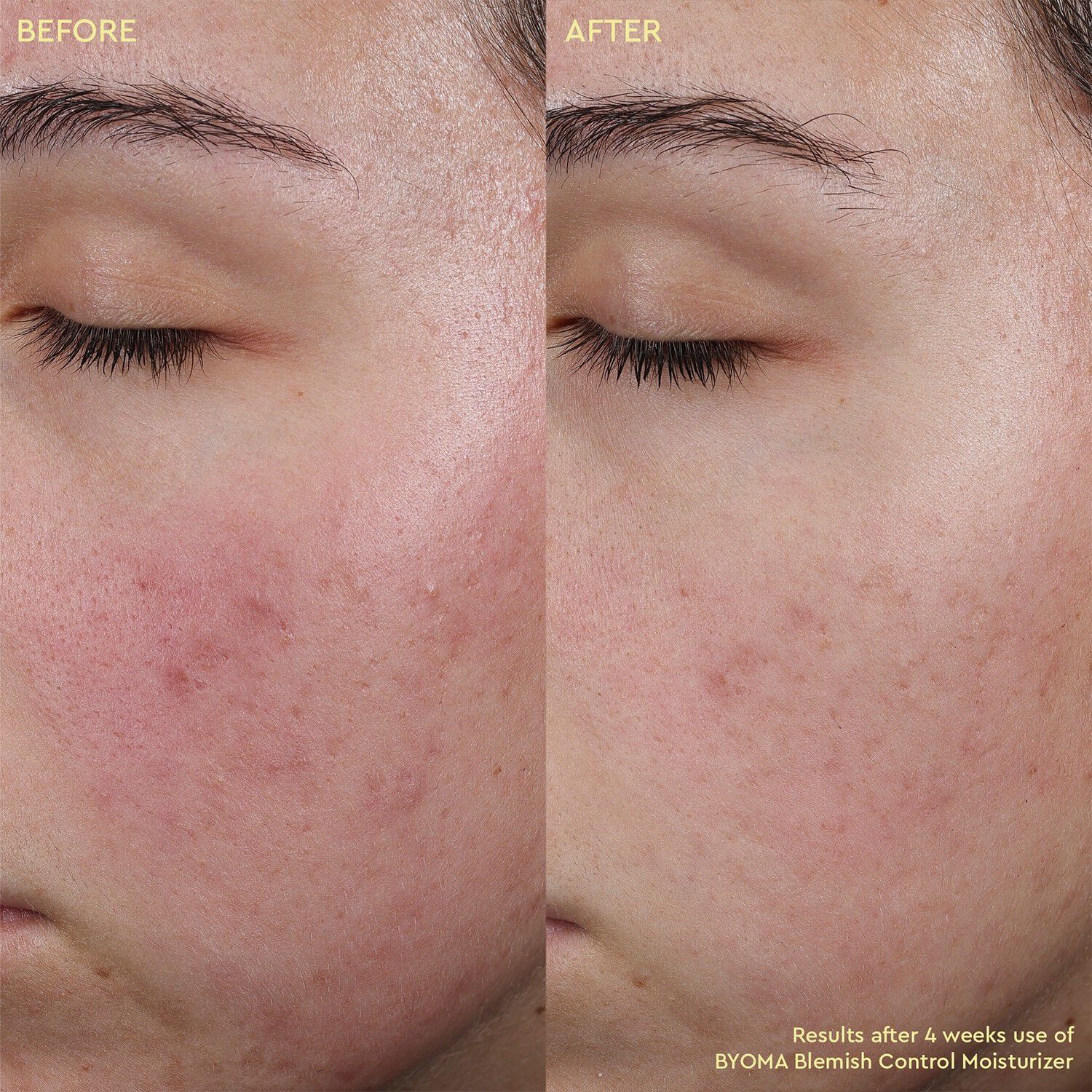 Blemish Control Moisturizer - Fuktkr&auml;m som motverkar oj&auml;mnheter