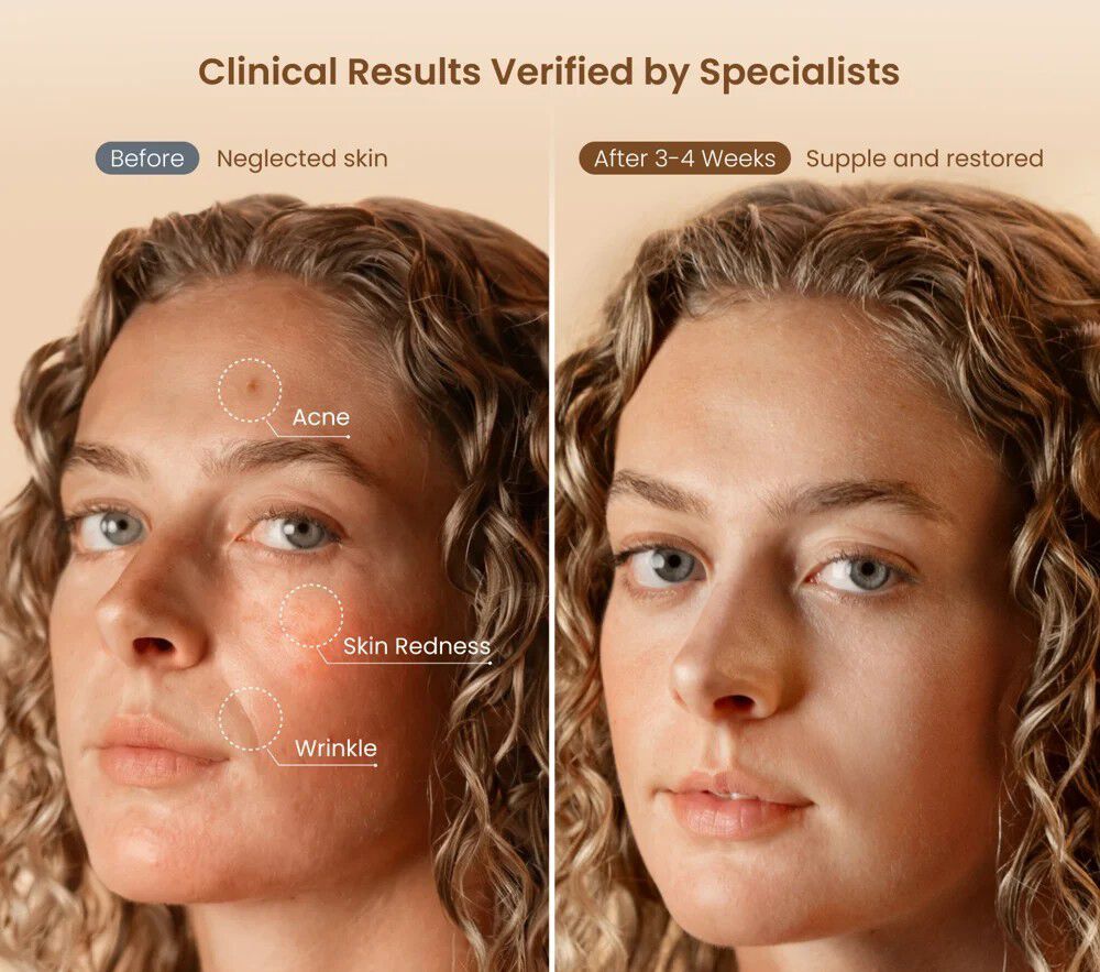 Artimis Blush Light Mask