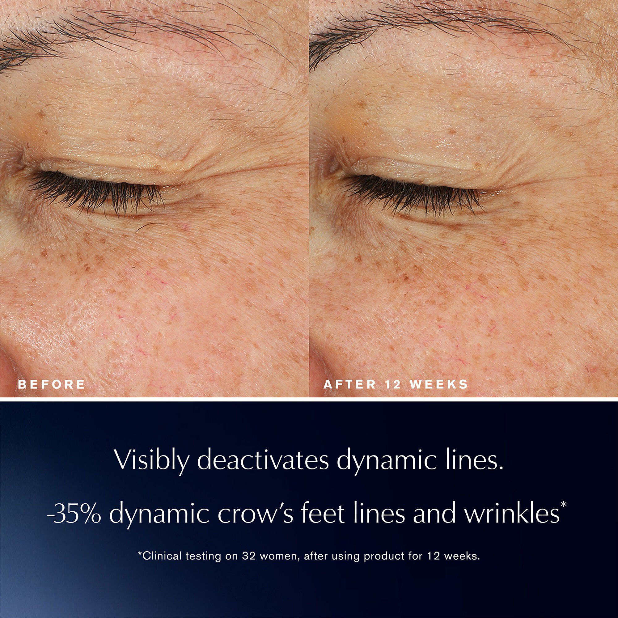 Advanced Night Repair Eye Lift + Sculpt Serum