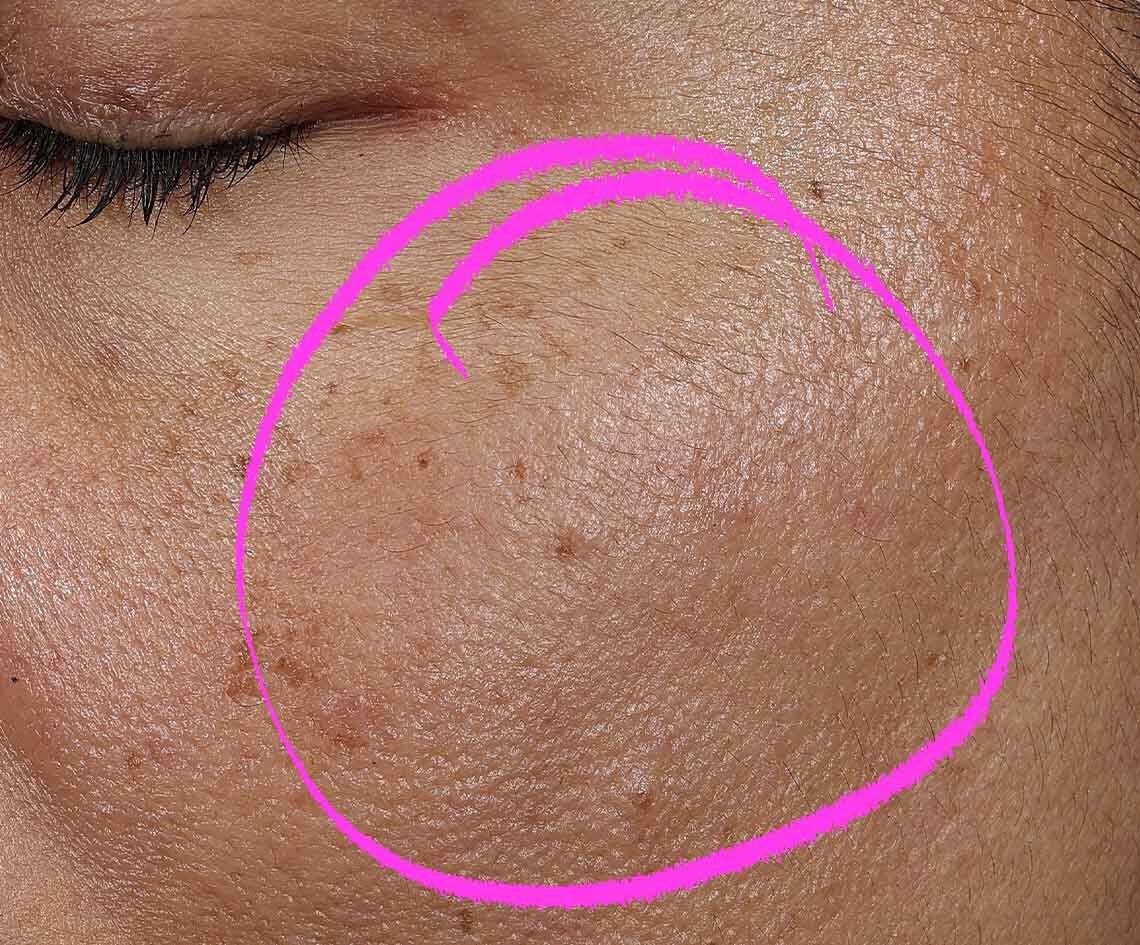 Collagen Shot Serum