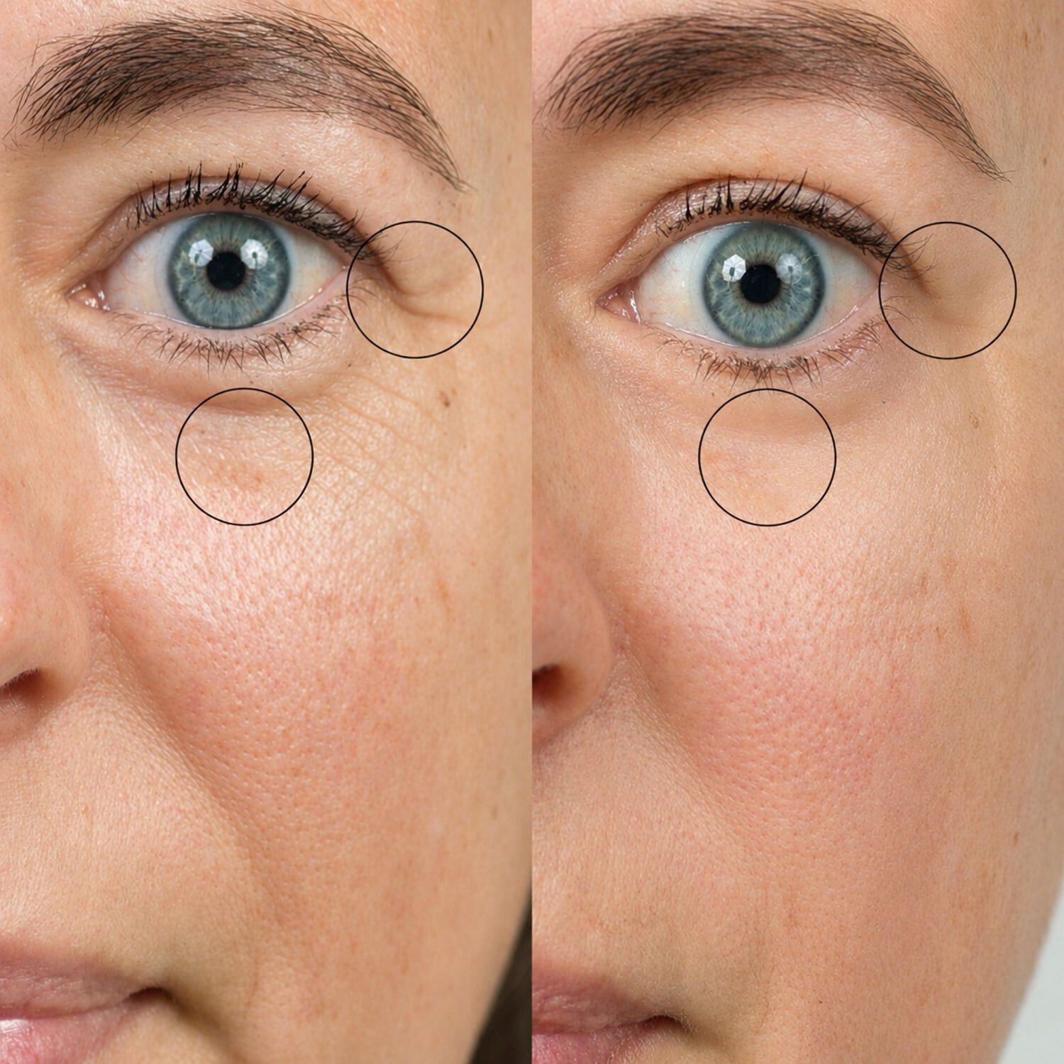 Bio-active Ceramide Eye Cream - &Ouml;gonkr&auml;m med bioaktiva ceramider