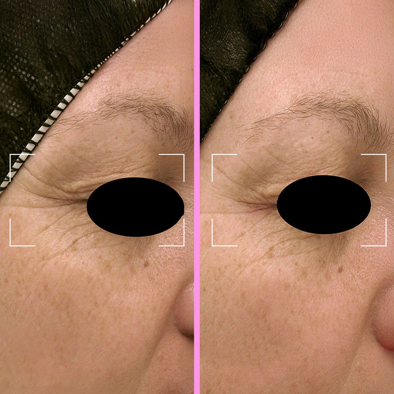 Repair Capsules - Regenererande serum med niacinamid, fotolyas och pep