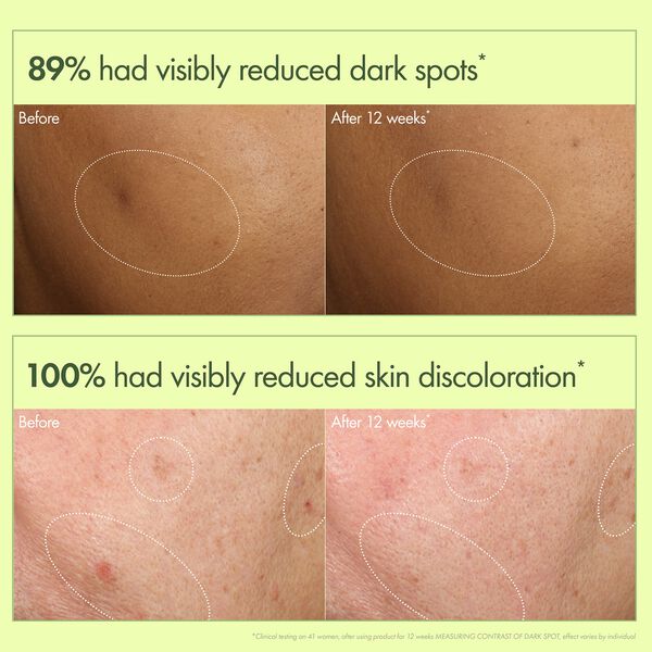 Dr. Weil Mega-Mushroom Dark Spot Correcting Brightening Serum