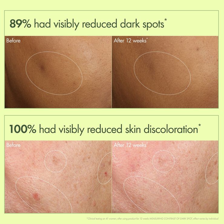 Dr. Weil Mega-Mushroom Dark Spot Correcting Brightening Serum