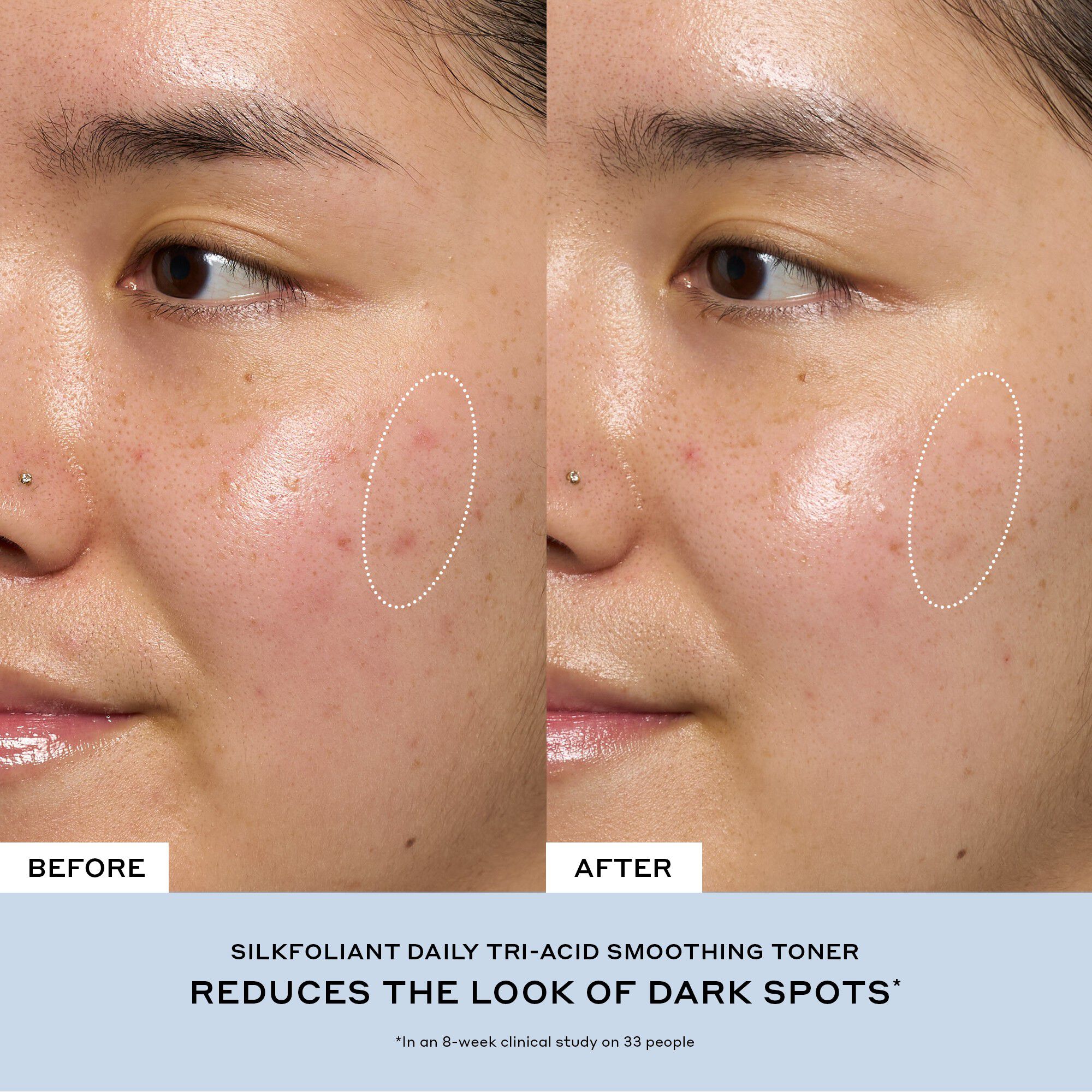 Transform Exfoliating Treatment Toner