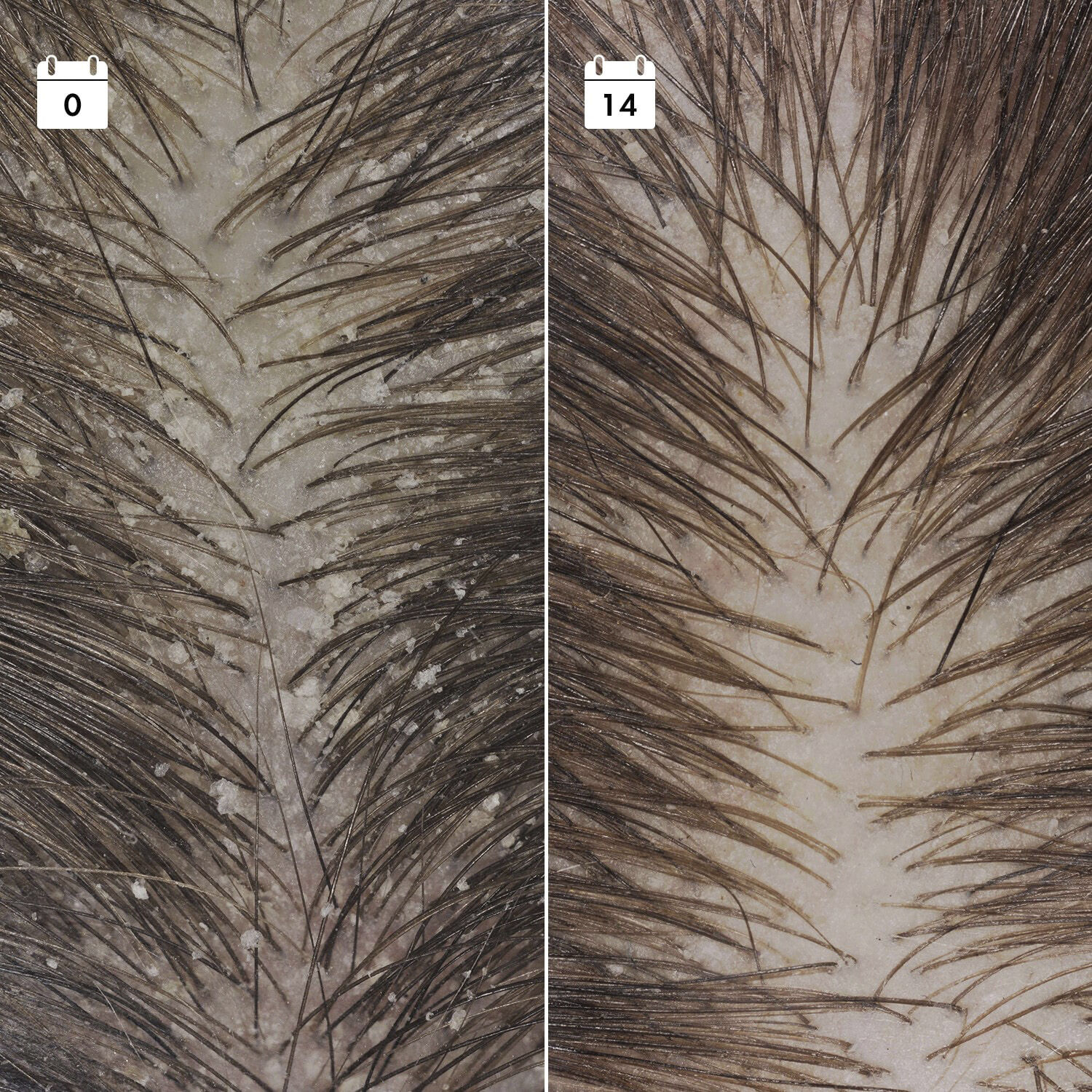 Serum Anti-Pelliculaire Anti-Recidive - Serum f&ouml;r h&aring;rbotten