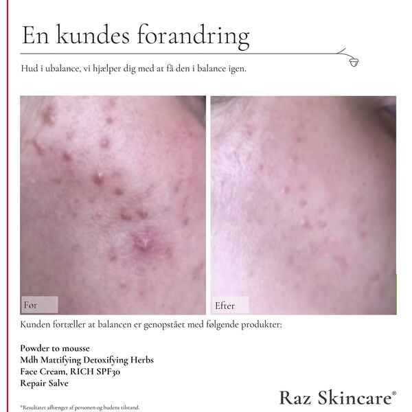 Raz Skincare Powder to Mousse 50 g