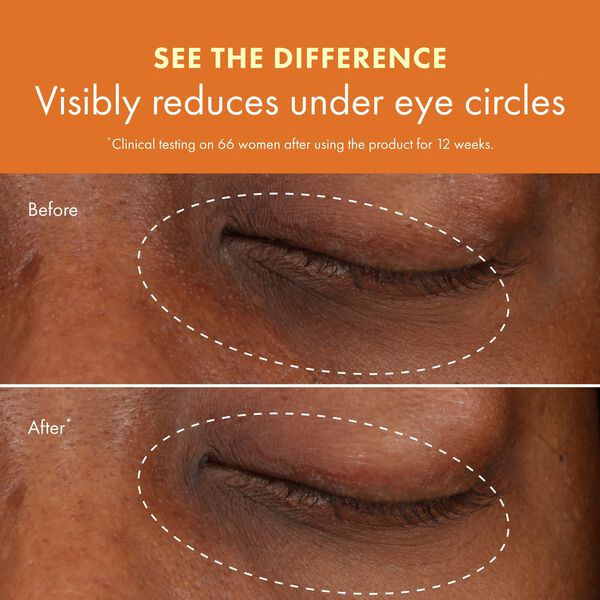 Ginzing Brightening Eye Cream Warm